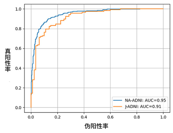 富士膠片AI技術(shù)可預(yù)測認(rèn)知癥是否會(huì)進(jìn)展為阿爾茨海默病