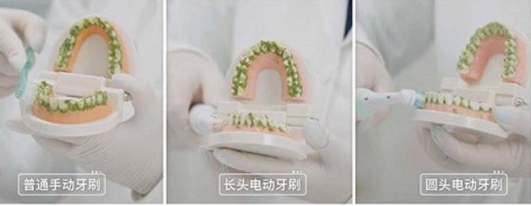 清潔力對(duì)比：普通手動(dòng)牙刷、長(zhǎng)頭電動(dòng)牙刷及圓頭電動(dòng)牙刷