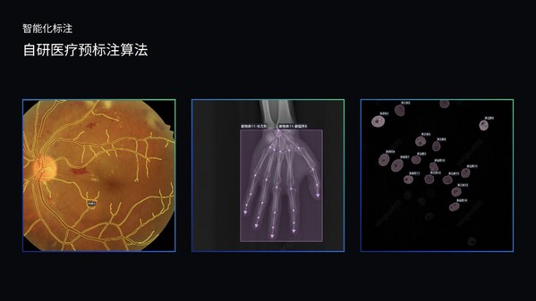 澳鵬MediGo平臺集成醫(yī)療專用NER模型、問答對自動生成系統(tǒng)和自研預標注算法